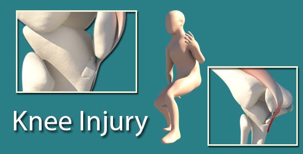 Knee Injury - Download 14399323 Videohive