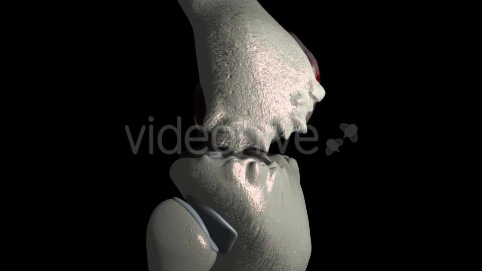 Knee Osteoarthritis With Osteophytes Videohive 21400790 Motion Graphics Image 10