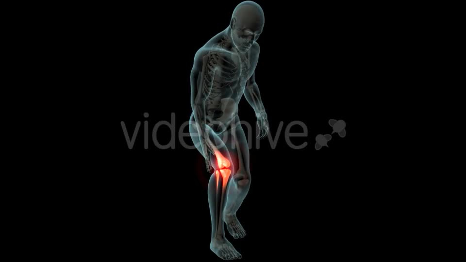 Knee Pain Videohive 21255650 Motion Graphics Image 1