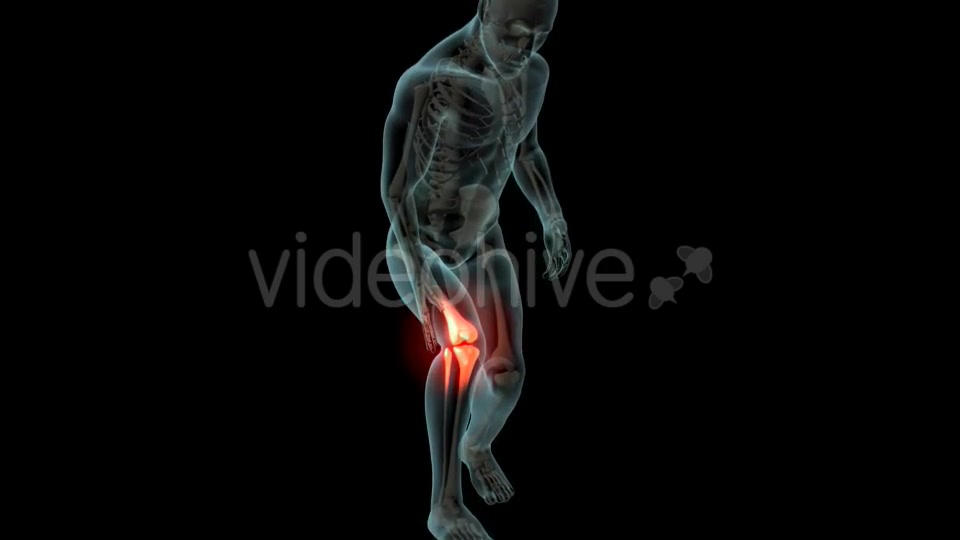 Knee Pain Videohive 21255650 Motion Graphics Image 2