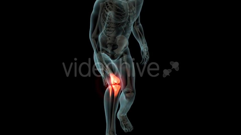 Knee Pain Videohive 21255650 Motion Graphics Image 3