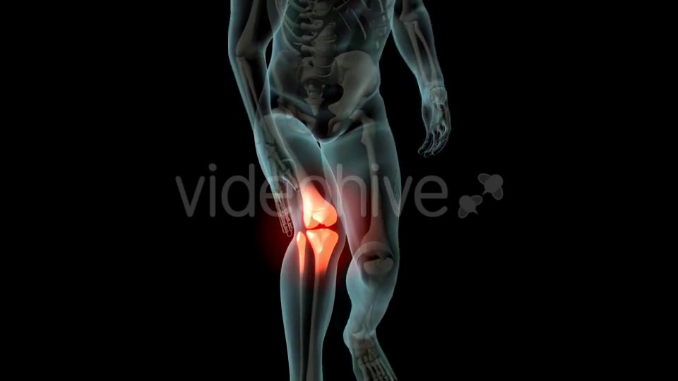 Knee Pain Videohive 21255650 Motion Graphics Image 4