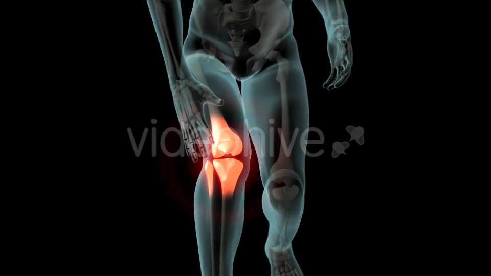 Knee Pain Videohive 21255650 Motion Graphics Image 5