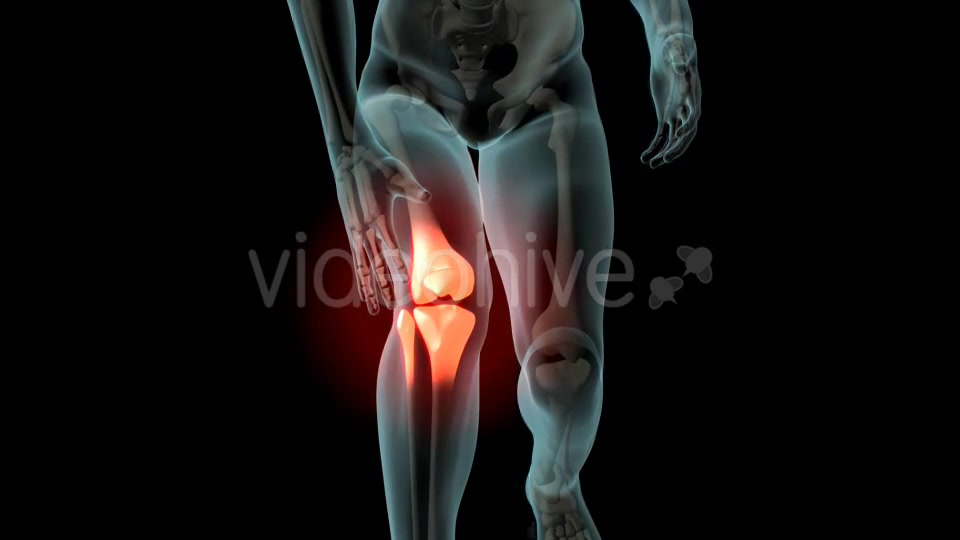 Knee Pain Videohive 21255650 Motion Graphics Image 6