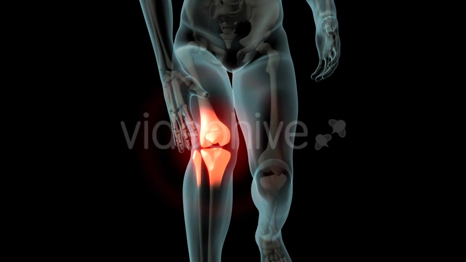 Knee Pain Videohive 21255650 Motion Graphics Image 7