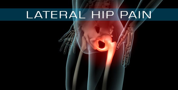 Lateral Hip Pain - 21246229 Videohive Download