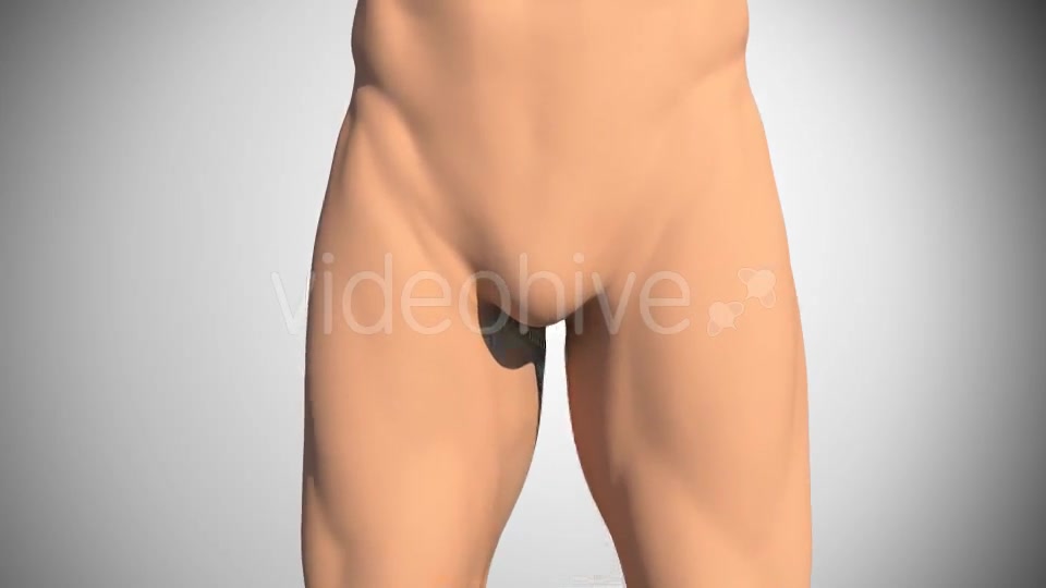 Lesion Of The Acetabular Labrum Hip Videohive 14941410 Motion Graphics Image 2