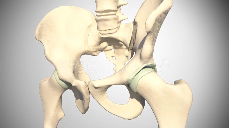 Lesion Of The Acetabular Labrum Hip Videohive 14941410 Motion Graphics Image 3