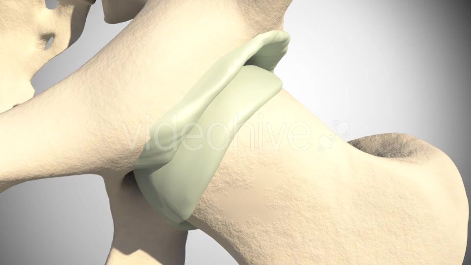 Lesion Of The Acetabular Labrum Hip Videohive 14941410 Motion Graphics Image 5
