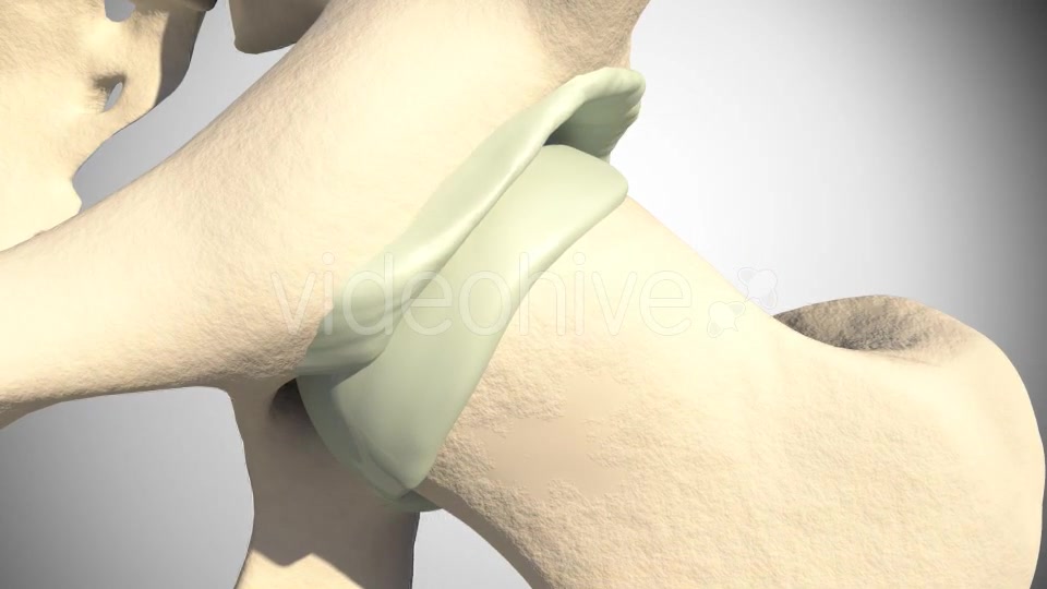 Lesion Of The Acetabular Labrum Hip Videohive 14941410 Motion Graphics Image 6