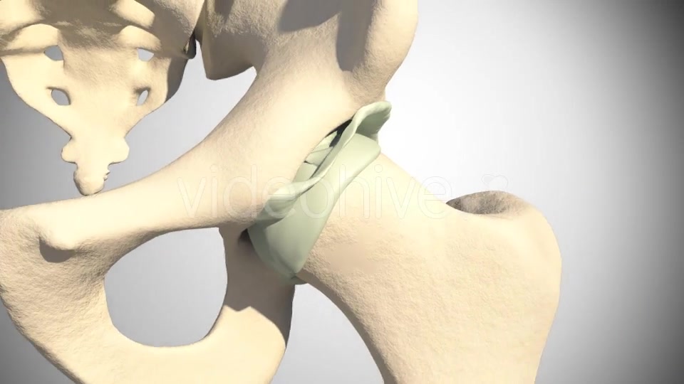 Lesion Of The Acetabular Labrum Hip Videohive 14941410 Motion Graphics Image 7