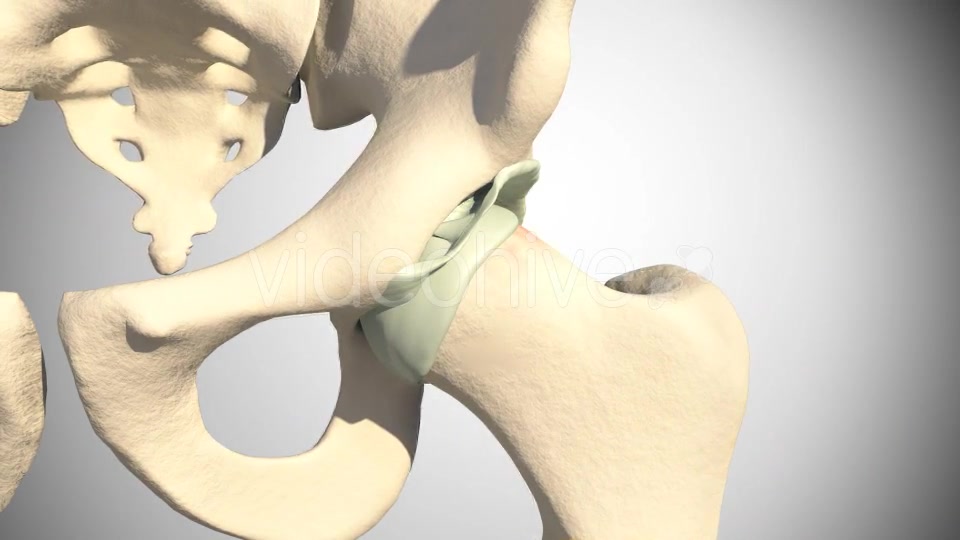 Lesion Of The Acetabular Labrum Hip Videohive 14941410 Motion Graphics Image 8