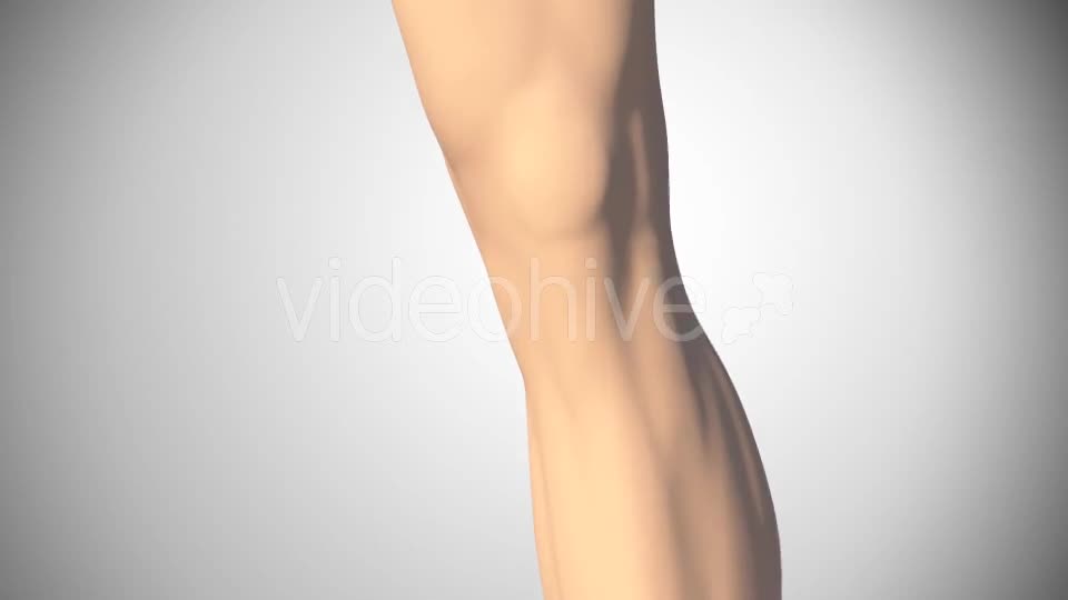 Lesion Of The Knee Cartilage Videohive 14813479 Motion Graphics Image 1
