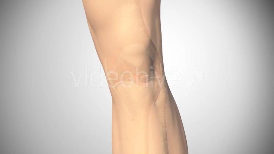 Lesion Of The Knee Cartilage Videohive 14813479 Motion Graphics Image 10