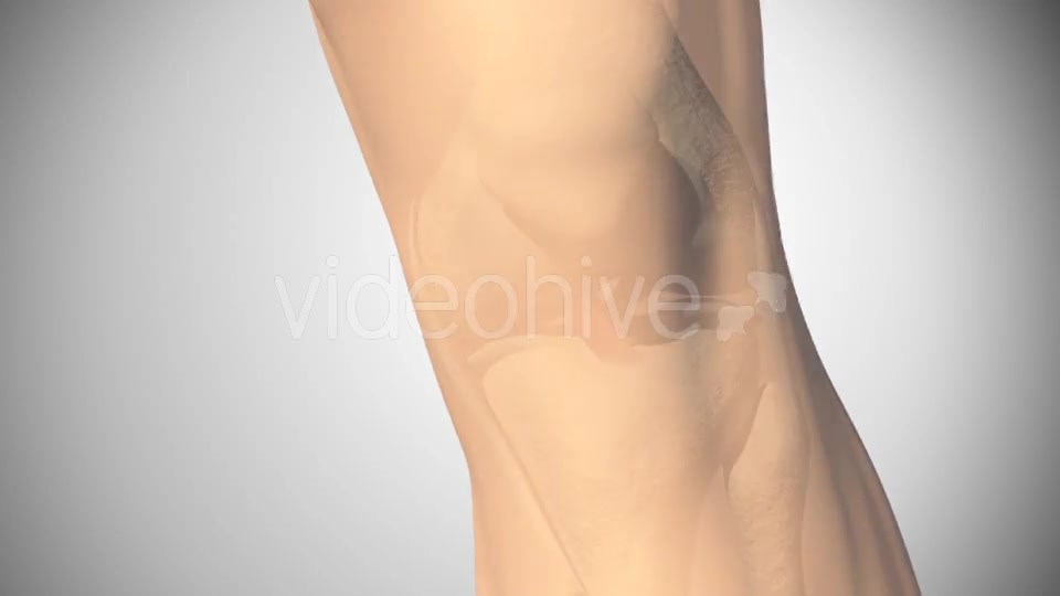 Lesion Of The Knee Cartilage Videohive 14813479 Motion Graphics Image 3