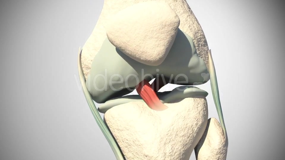 Lesion Of The Knee Cartilage Videohive 14813479 Motion Graphics Image 4