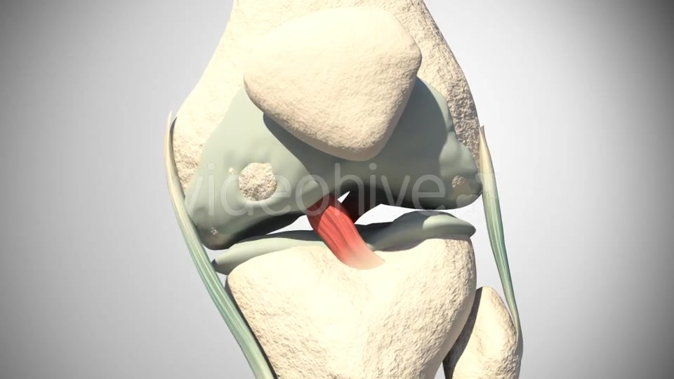 Lesion Of The Knee Cartilage Videohive 14813479 Motion Graphics Image 5
