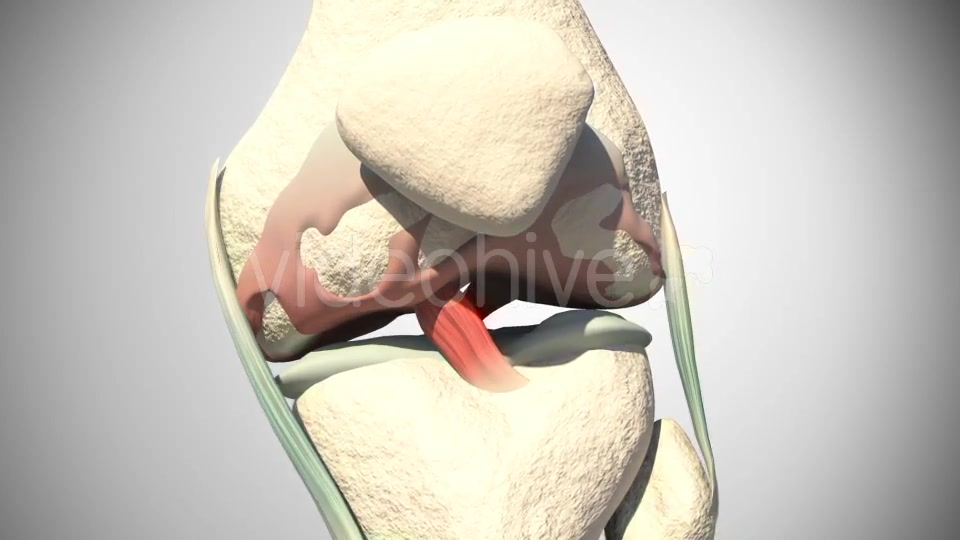 Lesion Of The Knee Cartilage Videohive 14813479 Motion Graphics Image 6