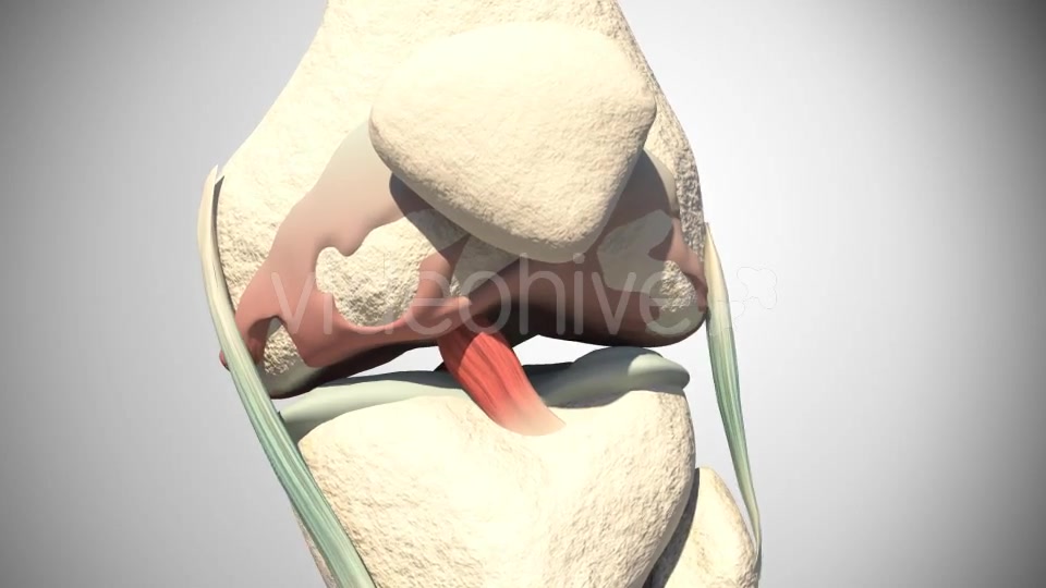 Lesion Of The Knee Cartilage Videohive 14813479 Motion Graphics Image 7