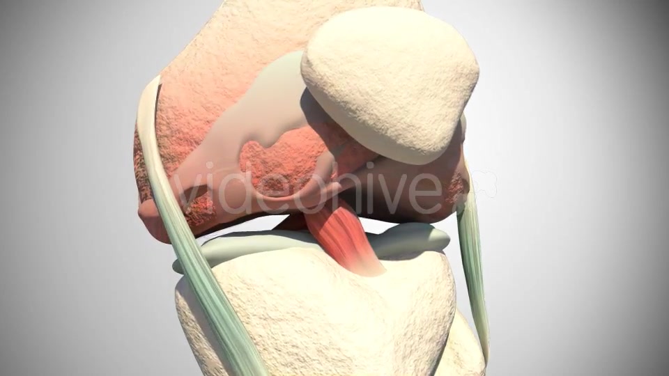 Lesion Of The Knee Cartilage Videohive 14813479 Motion Graphics Image 8