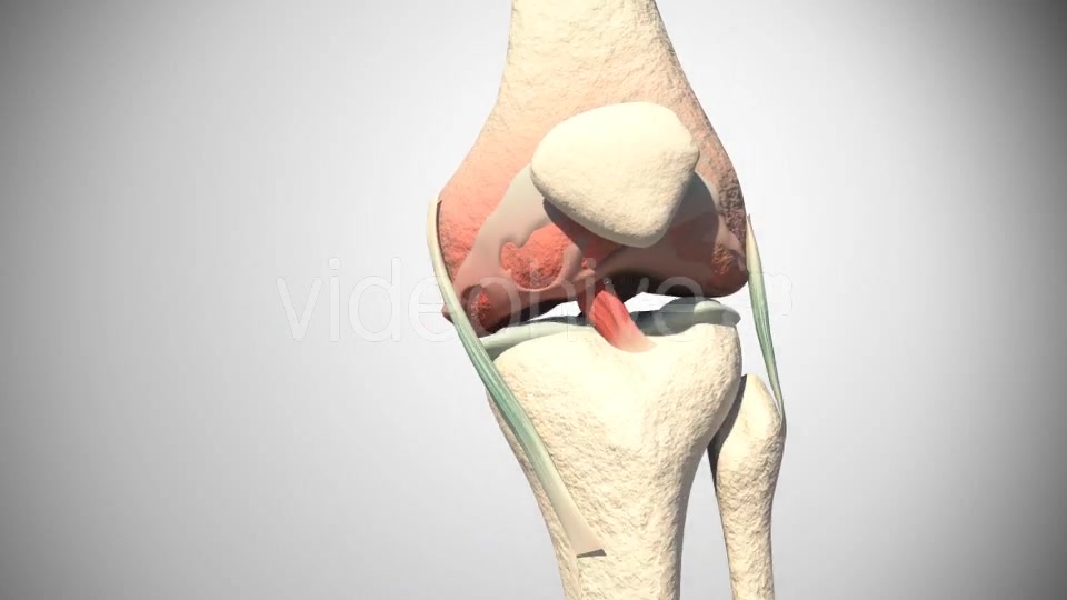 Lesion Of The Knee Cartilage Videohive 14813479 Motion Graphics Image 9