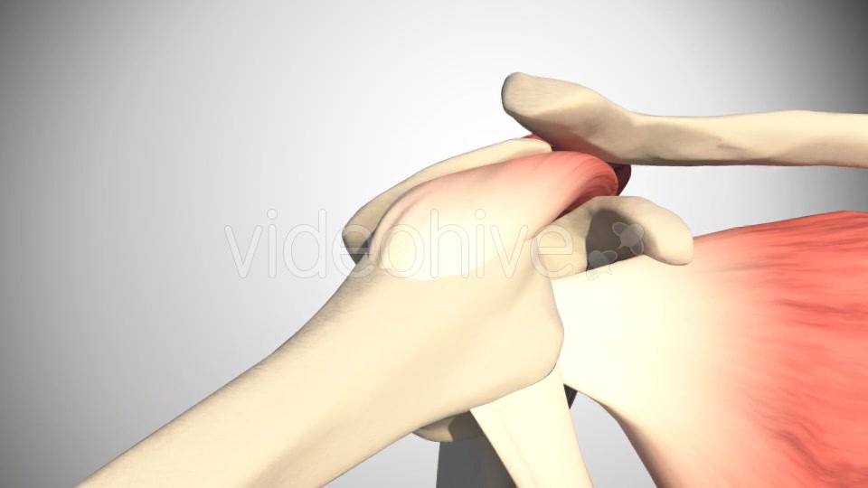 Lesion Of The Rotator Cuff Videohive 16084951 Motion Graphics Image 5
