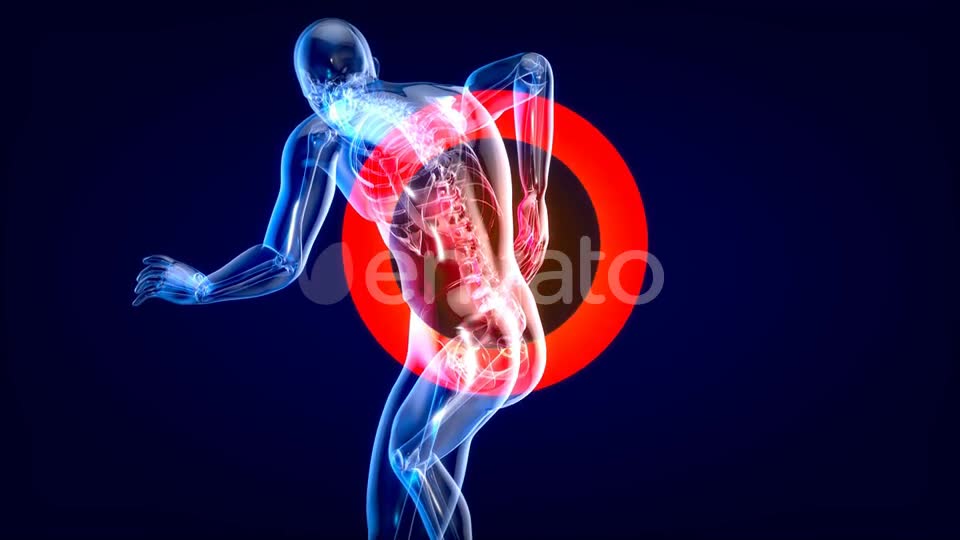 Man suffering of massive back pain Videohive 24753634 Motion Graphics Image 10