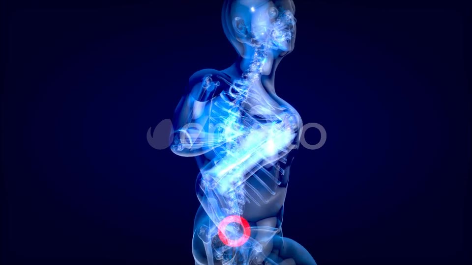 Man suffering of massive back pain Videohive 24753634 Motion Graphics Image 2