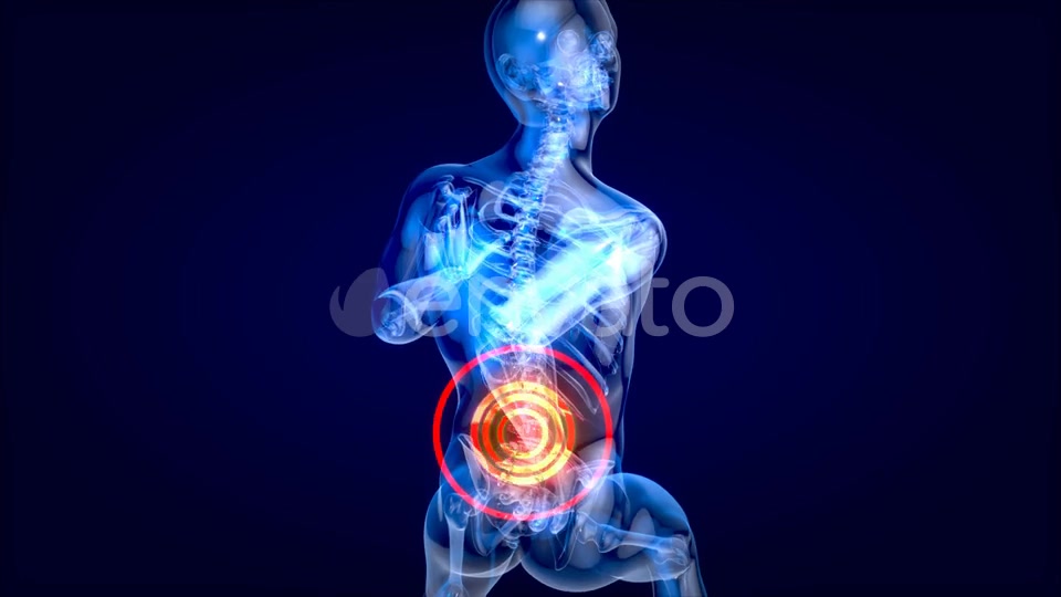 Man suffering of massive back pain Videohive 24753634 Motion Graphics Image 3