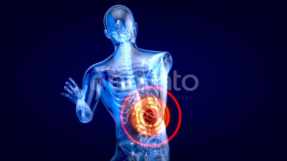 Man suffering of massive back pain Videohive 24753634 Motion Graphics Image 5