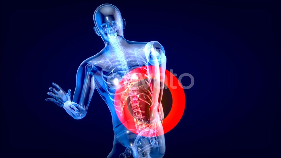 Man suffering of massive back pain Videohive 24753634 Motion Graphics Image 6