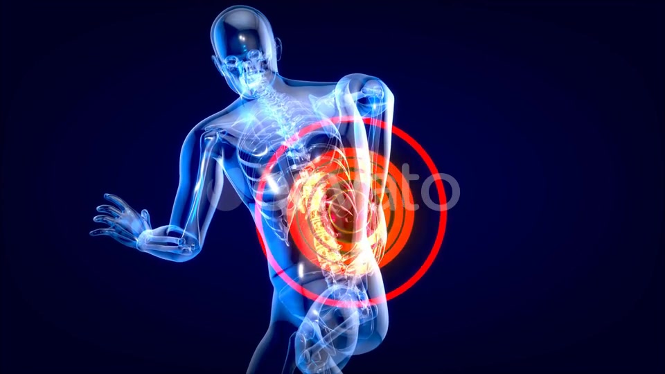Man suffering of massive back pain Videohive 24753634 Motion Graphics Image 7