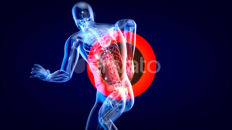 Man suffering of massive back pain Videohive 24753634 Motion Graphics Image 8
