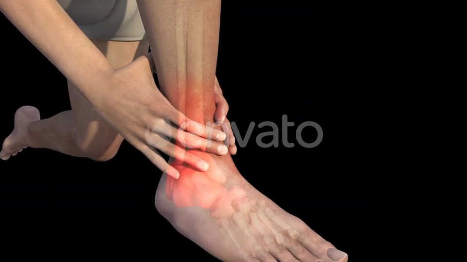 Man With Ankle Pain Videohive 22723975 Motion Graphics Image 5