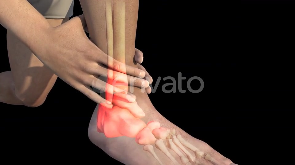 Man With Ankle Pain Videohive 22723975 Motion Graphics Image 6