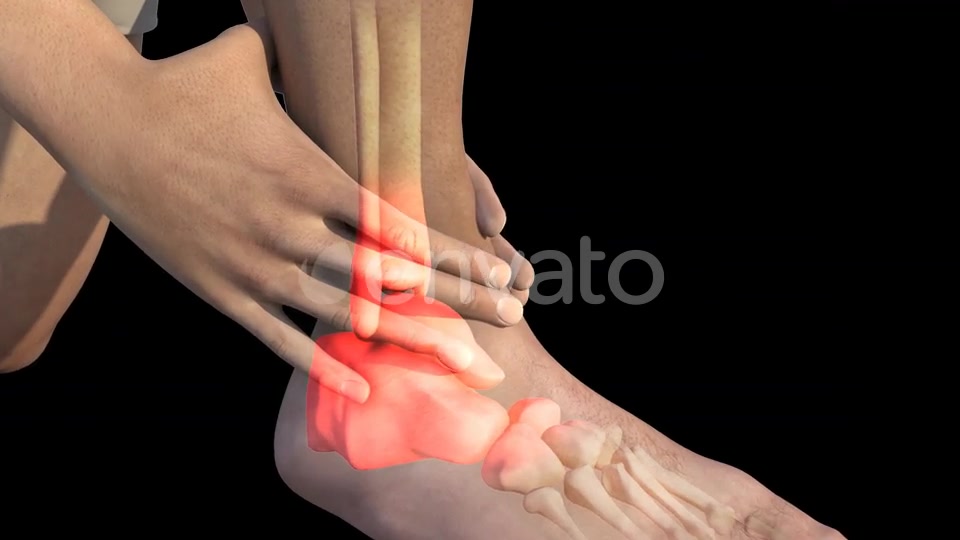 Man With Ankle Pain Videohive 22723975 Motion Graphics Image 7
