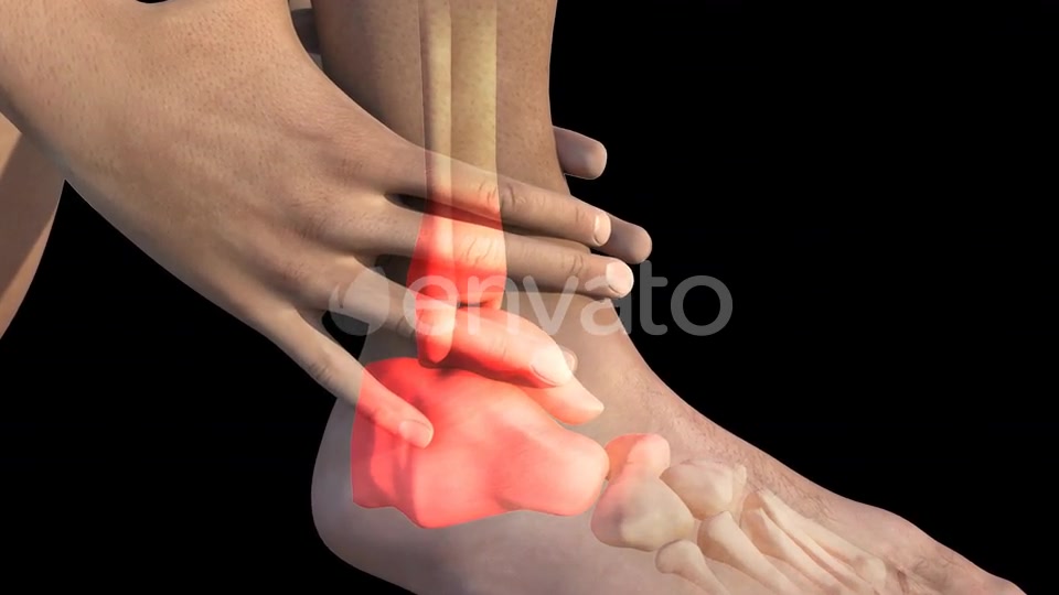 Man With Ankle Pain Videohive 22723975 Motion Graphics Image 8