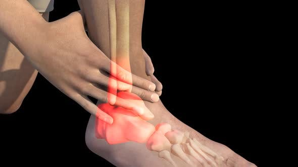 Man With Ankle Pain - Download 22723975 Videohive
