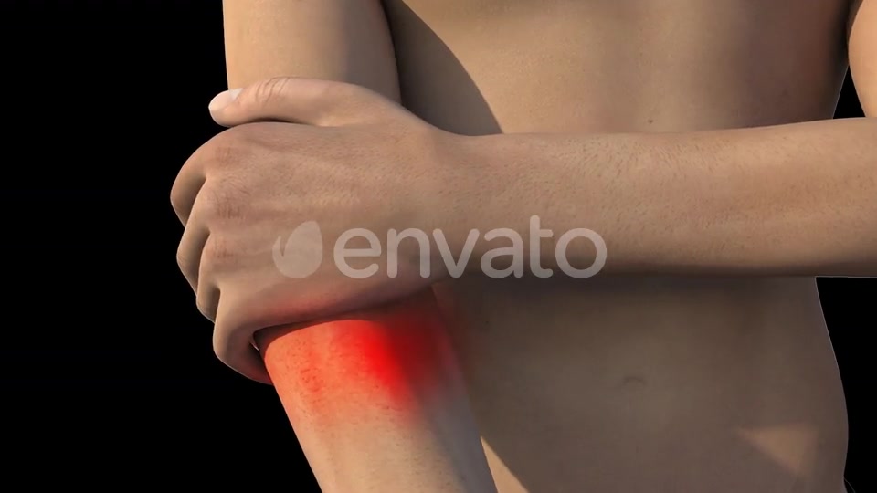 Man With Elbow Pain Videohive 22741730 Motion Graphics Image 3