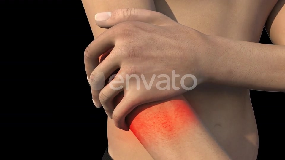 Man With Elbow Pain Videohive 22741730 Motion Graphics Image 4
