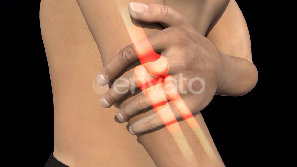 Man With Elbow Pain Videohive 22741730 Motion Graphics Image 6