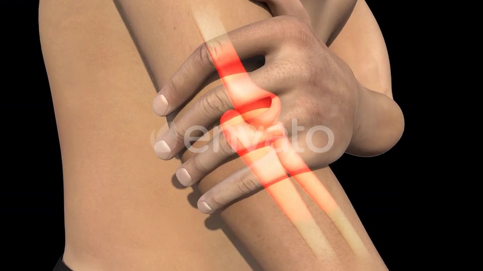 Man With Elbow Pain Videohive 22741730 Motion Graphics Image 7