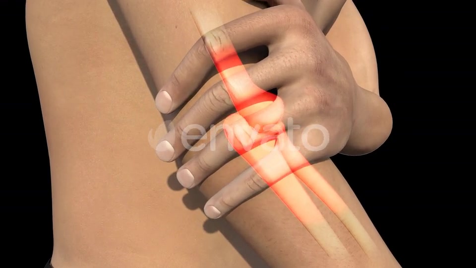 Man With Elbow Pain Videohive 22741730 Motion Graphics Image 8
