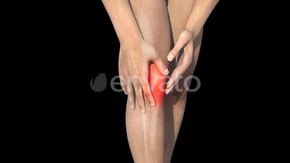 Man With Knee Pain Videohive 22716596 Motion Graphics Image 5