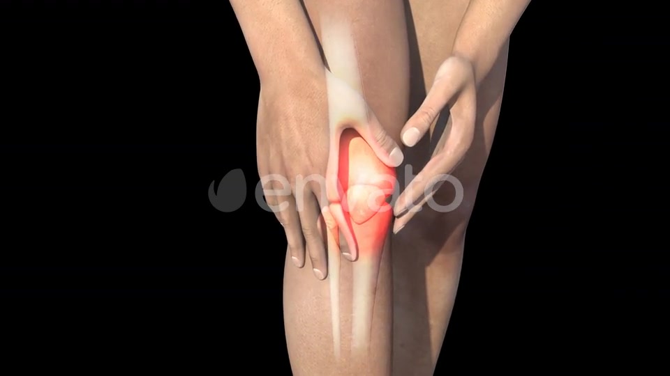 Man With Knee Pain Videohive 22716596 Motion Graphics Image 6
