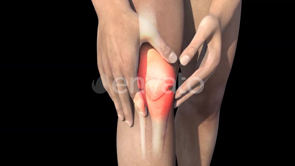Man With Knee Pain Videohive 22716596 Motion Graphics Image 7