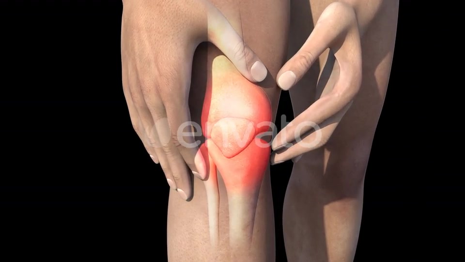Man With Knee Pain Videohive 22716596 Motion Graphics Image 8