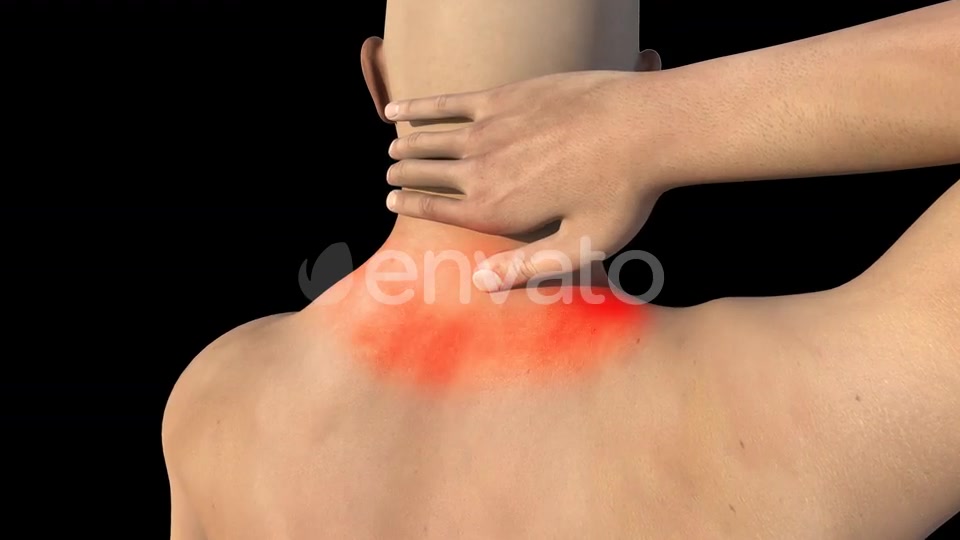 Man With Neck Pain Videohive 22730746 Motion Graphics Image 3
