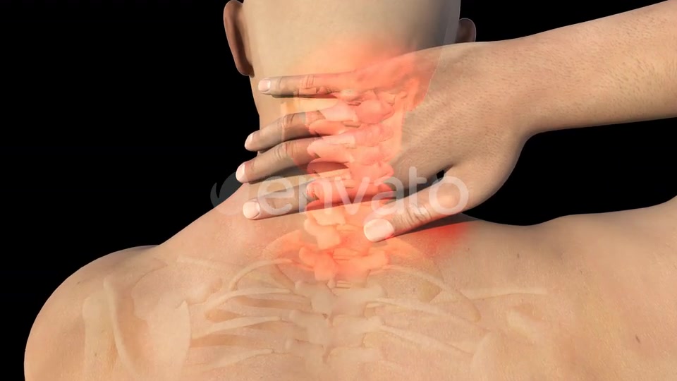 Man With Neck Pain Videohive 22730746 Motion Graphics Image 5
