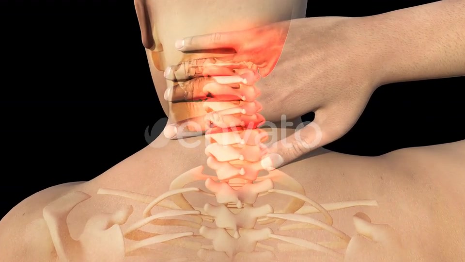 Man With Neck Pain Videohive 22730746 Motion Graphics Image 6